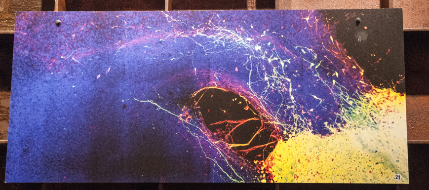 Medularte_20200107291