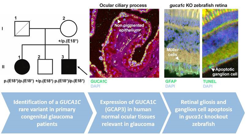 Importante descubrimiento sobre el glaucoma en la UCLM